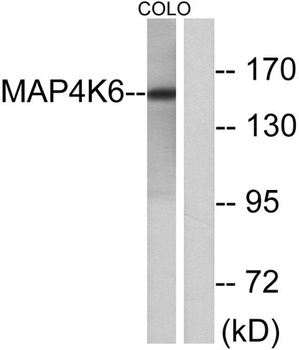 MINK1 rabbit pAb Antibody