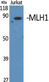 MLH1 rabbit pAb Antibody