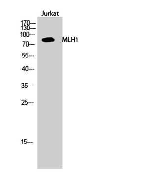 MLH1 rabbit pAb Antibody