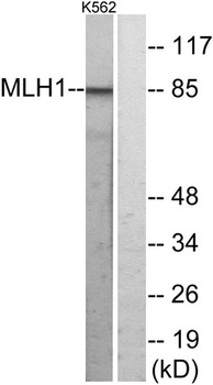 MLH1 rabbit pAb Antibody
