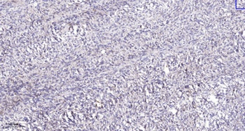 MLH1 rabbit pAb Antibody