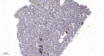 MLKL rabbit pAb Antibody