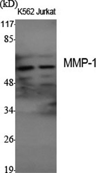 MMP-1 rabbit pAb Antibody
