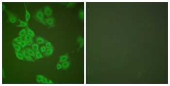 MMP-11 rabbit pAb Antibody