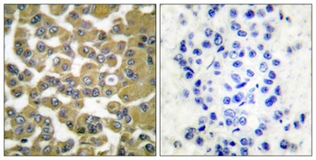 MMP-11 rabbit pAb Antibody