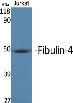 MNT rabbit pAb Antibody