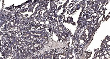 MNT rabbit pAb Antibody