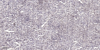 MOV10L1 rabbit pAb Antibody