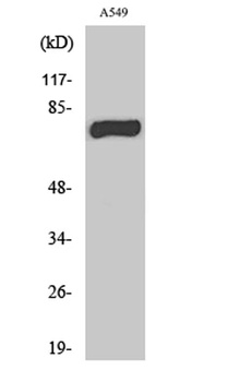 MPP9 rabbit pAb Antibody