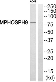 MPP9 rabbit pAb Antibody