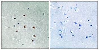 MRE11 rabbit pAb Antibody