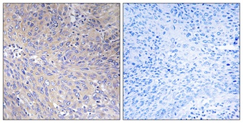MRP-L11 rabbit pAb Antibody