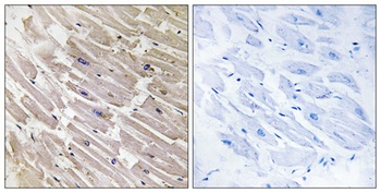 MRP-L16 rabbit pAb Antibody