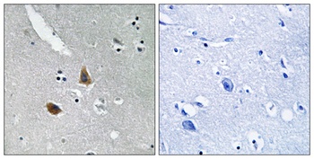 MRP-L21 rabbit pAb Antibody