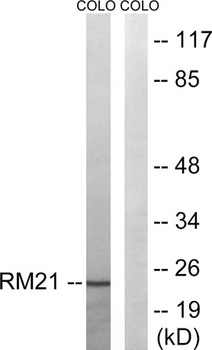 MRP-L21 rabbit pAb Antibody