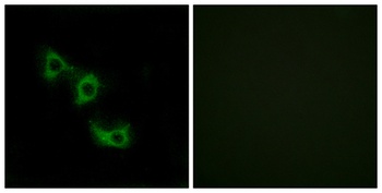 MRP-L44 rabbit pAb Antibody