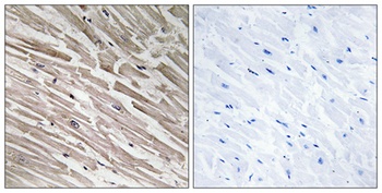 MRP-L44 rabbit pAb Antibody