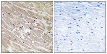 MRP-L46 rabbit pAb Antibody