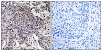 MRP-L54 rabbit pAb Antibody