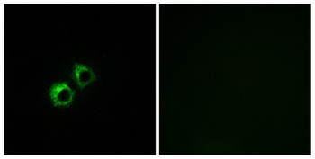 MRP-S21 rabbit pAb Antibody