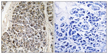 MRP-S21 rabbit pAb Antibody
