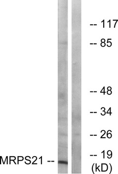 MRP-S21 rabbit pAb Antibody
