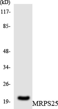 MRP-S25 rabbit pAb Antibody