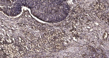 MRP-S25 rabbit pAb Antibody