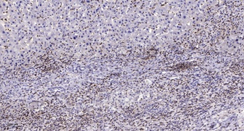 MRP-S27 rabbit pAb Antibody