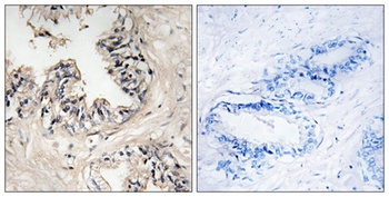 MRP-S36 rabbit pAb Antibody
