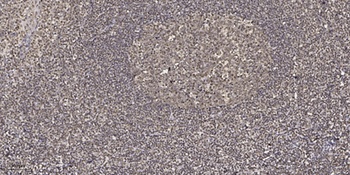 MSH3 rabbit pAb Antibody