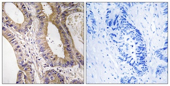MST-3 rabbit pAb Antibody