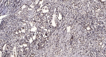 MYL3 rabbit pAb Antibody