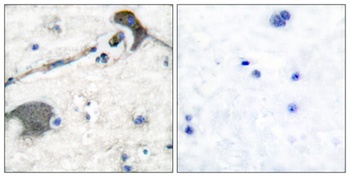 N/H/K-Ras rabbit pAb Antibody