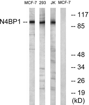 N4BP1 rabbit pAb Antibody