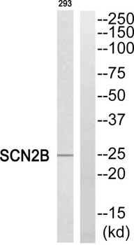 Na+ CP type IIβ rabbit pAb Antibody