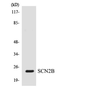 Na+ CP type IIβ rabbit pAb Antibody