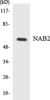 NAB2 rabbit pAb Antibody