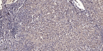Nanog P8 rabbit pAb Antibody