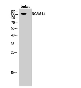NCAM-L1 rabbit pAb Antibody