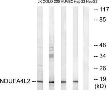 NDUFA4L2 rabbit pAb Antibody