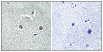 NDUFB10 rabbit pAb Antibody