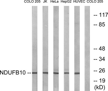 NDUFB10 rabbit pAb Antibody