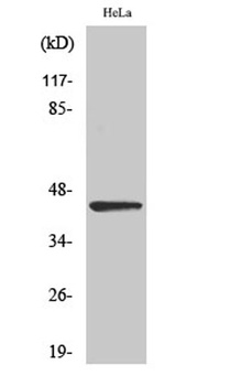 NEIL1 rabbit pAb Antibody