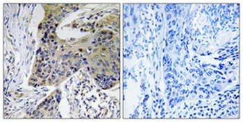 NF2 rabbit pAb Antibody
