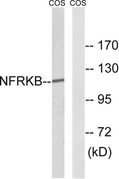 NFRκB rabbit pAb Antibody