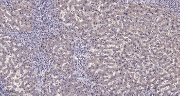 NFRκB rabbit pAb Antibody