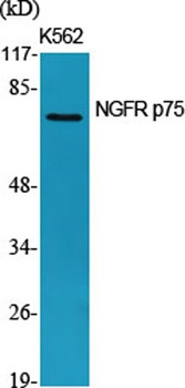 NGFR p75 rabbit pAb Antibody