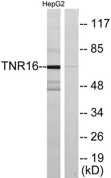 NGFR p75 rabbit pAb Antibody