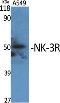 NK-3R rabbit pAb Antibody
